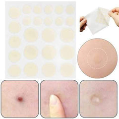 24Pcs Face Spot Scar Care Treatment Stickers Acne Patches